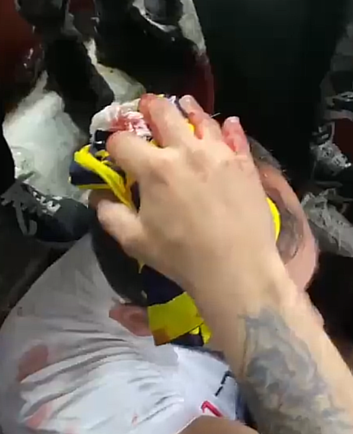 İspanyol polisinin Sevilla Fenerbahçeli taraftarlara müdahalesi maçın önüne geçmişti! Taraftarların kanlar içinde yerde kaldığı yeni görüntüler ortaya çıktı G1