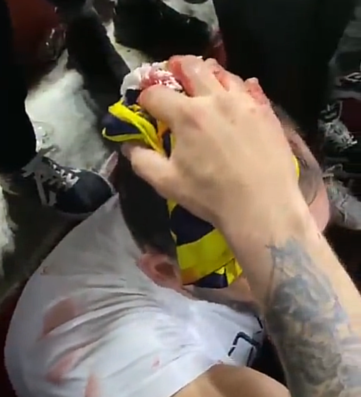 İspanyol polisinin Sevilla Fenerbahçeli taraftarlara müdahalesi maçın önüne geçmişti! Taraftarların kanlar içinde yerde kaldığı yeni görüntüler ortaya çıktı G3