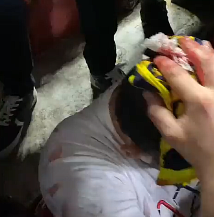 İspanyol polisinin Sevilla Fenerbahçeli taraftarlara müdahalesi maçın önüne geçmişti! Taraftarların kanlar içinde yerde kaldığı yeni görüntüler ortaya çıktı G4