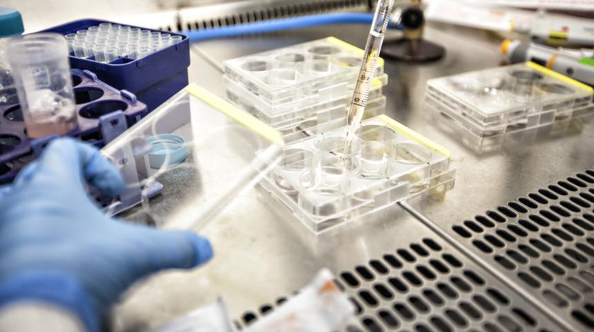 Tıp tarihine geçecek araştırmanın başında bir Türk var! Hastalıkların nedeni bulundu