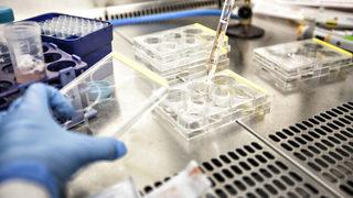 Tıp tarihine geçecek araştırmanın başında bir Türk var! Hastalıkların nedeni bulundu