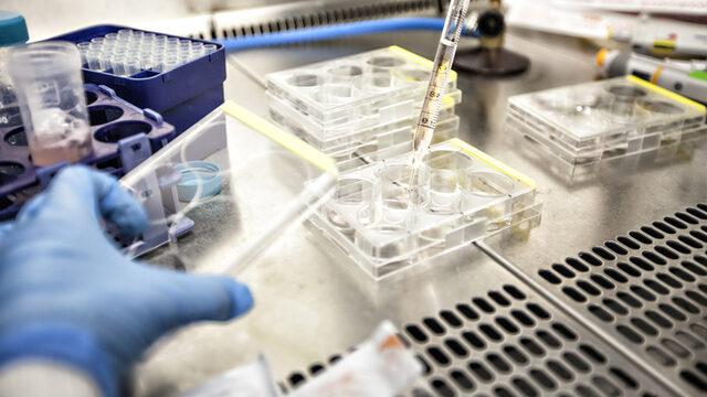 Tıp tarihine geçecek araştırmanın başında bir Türk var! Hastalıkların nedeni bulundu