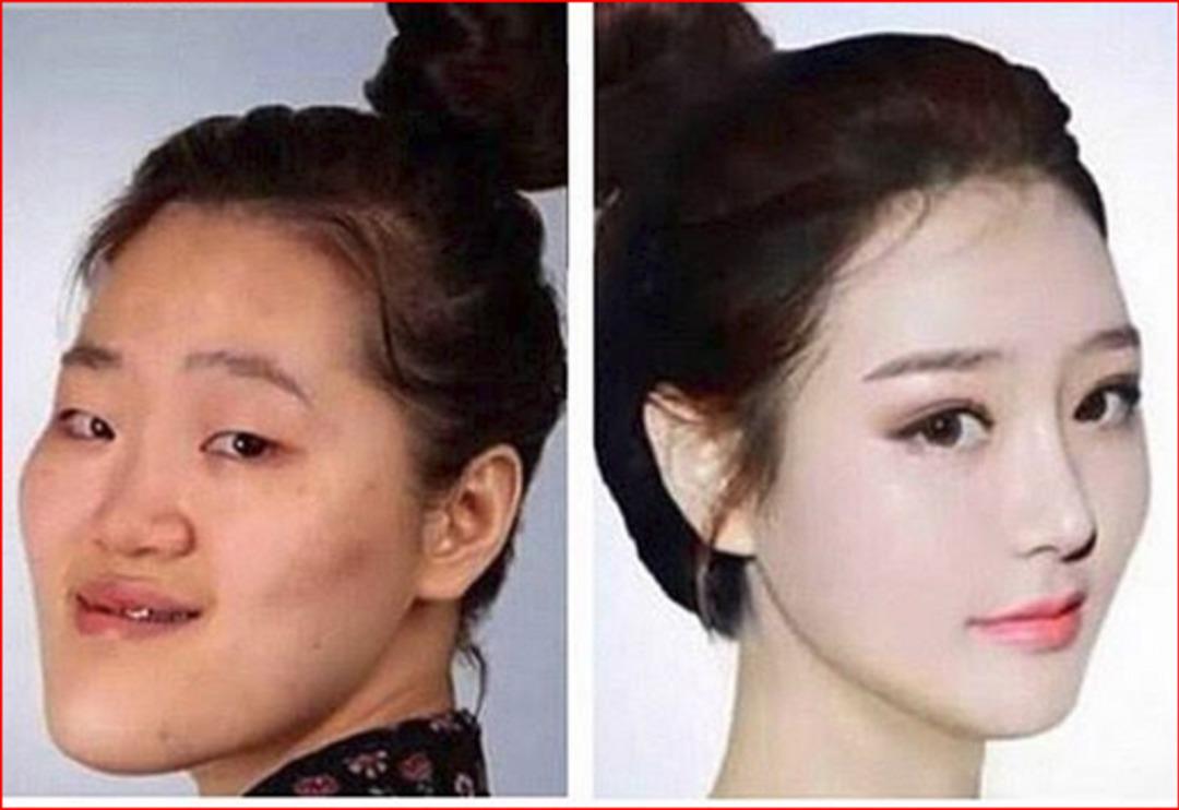 Estetik ameliyat sonrası tanınmaz hale geldiler