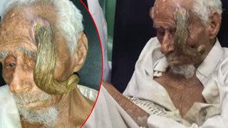 100 yaşından sonra kafasında boynuz çıktı! 'Dünyanın en yaşlı adamı' 140 yaşında hayatını kaybetti... Bir gören bir daha baktı