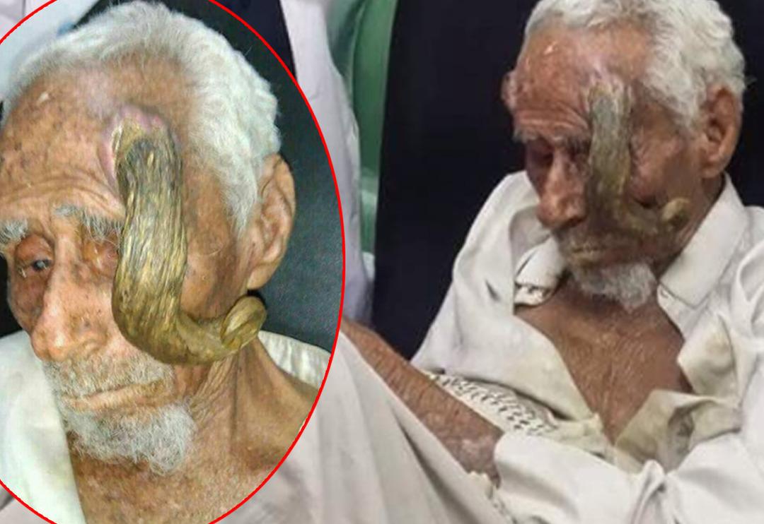 100 yaşından sonra kafasında boynuz &ccedil;ıktı! 'D&uuml;nyanın en yaşlı adamı' 140 yaşında hayatını kaybetti... Bir g&ouml;ren bir daha baktı