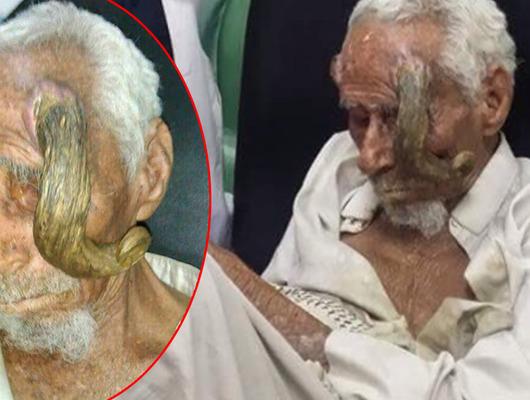 100 yaşından sonra kafasında boynuz çıkmıştı! Yaşını duyan şaşırıyordu