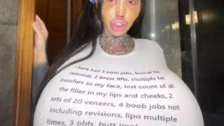 Dünyanın en büyük vajinasına ve göğüslerine sahip olmak için onlarca ameliyat olmuştu! İşler tersine döndü...Son halini gören tanımadı