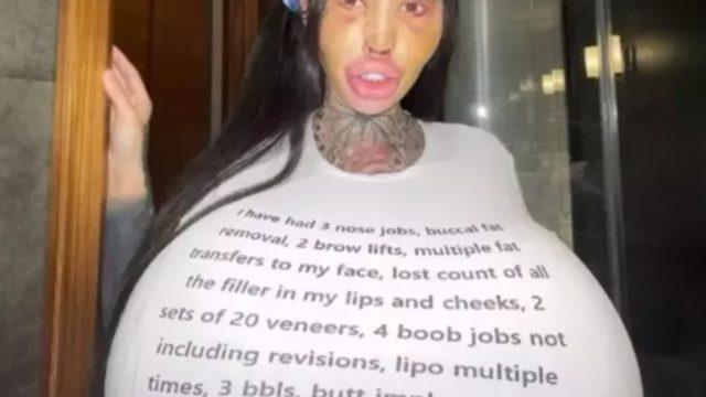 Dünyanın en büyük vajinasına ve göğüslerine sahip olmak için onlarca ameliyat olmuştu! İşler tersine döndü...Son halini gören tanımadı