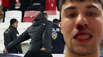 Sivas'ta skandal gece! Sahaya atlayan taraftar rakibin burnunu kırdı... "Tiksiniyorum"