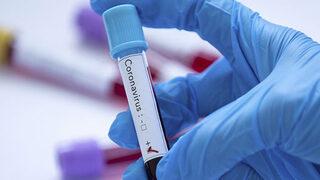 Dünya Sağlık Örgütü duyurdu! Bu yıl koronavirüsün halk sağlığı acil durumu olarak sona erdiği açıklanabilir