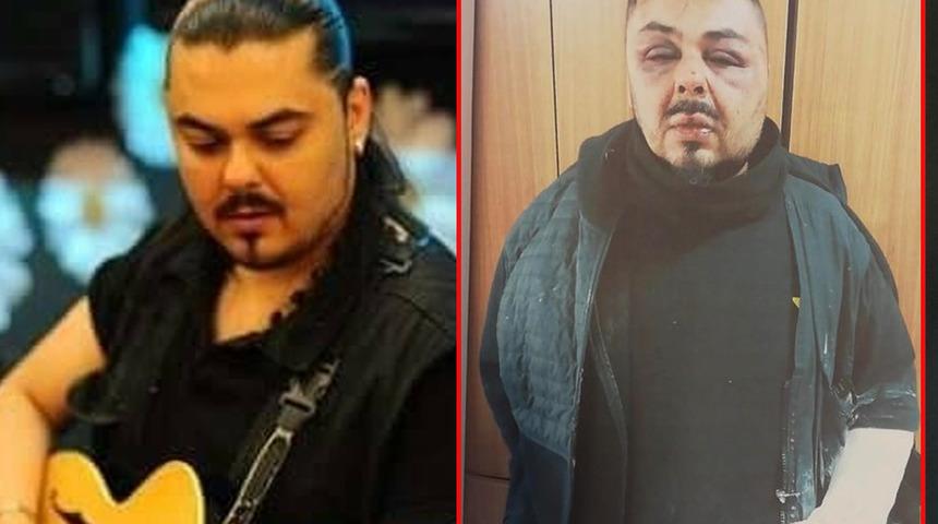 Gönderdiği arkadaşlık isteği kabusu oldu! Şarkıcı Hakan Akayran tanınmayacak hale geldi