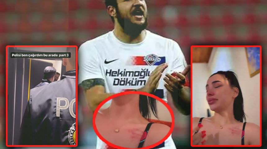 Son dakika: 'Polis baskını ve fiziksel şiddet!' Eski futbolcu Batuhan Karadeniz için olay iddia! Eski sevgilisi Aleyna Eroğlu, 'Şiddet gördüm' dedi, görüntüleri paylaştı...