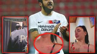 Son dakika: 'Polis baskını ve fiziksel şiddet!' Eski futbolcu Batuhan Karadeniz için olay iddia! Eski sevgilisi Aleyna Eroğlu, 'Şiddet gördüm' dedi, görüntüleri paylaştı...
