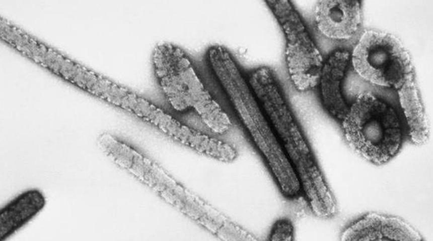 Tanzanya'da Marburg virüsü alarmı! 5 kişi hayatını kaybetti