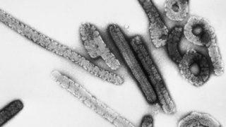 Tanzanya'da Marburg virüsü alarmı! 5 kişi hayatını kaybetti