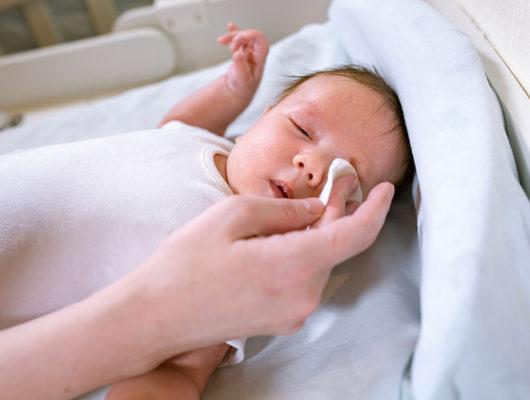Bebeklerde göz çapaklanması nasıl geçer?