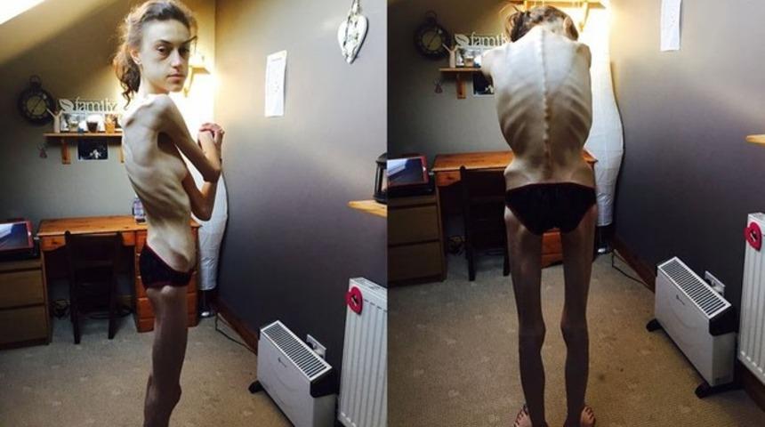 Sevgilisi yok diye bu hale geldi! Genç kızın korkunç görüntüsü