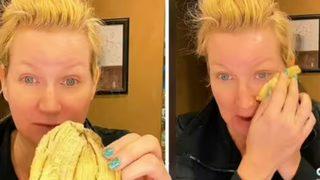 Yüzdeki kırışıklıkları geçirmek için botokstan daha etkili yöntemini paylaştı! Her evde bulunan yaşlılık karşıtı doğal çözüm