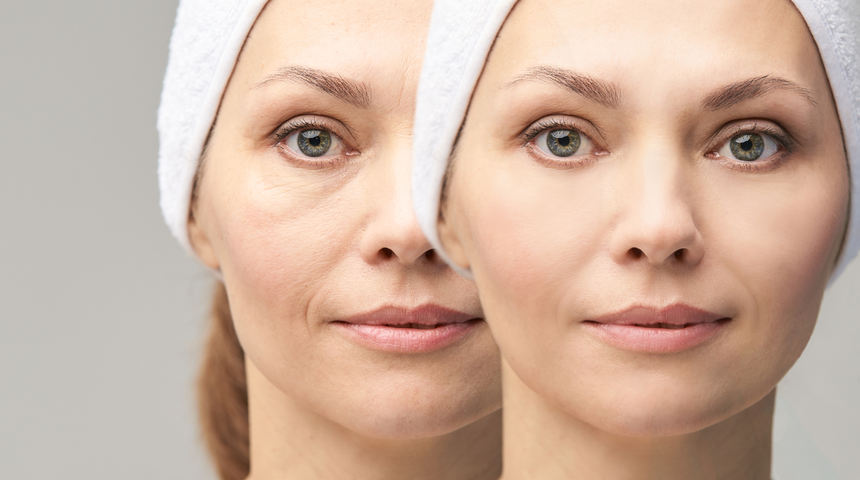 Uzmanı yaşlılık karşıtı 6 güzellik sırrını açıkladı! Botoks ve dolgu yaptırmadan genç görünmek mümkün