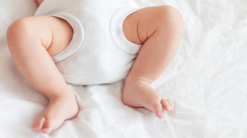 Bebeklerde kalça çıkıklığı nasıl anlaşılır, neden olur? Kalça çıkıklığı testi ne zaman yapılır, kalça çıkığı tedavisi nasıl yapılır?