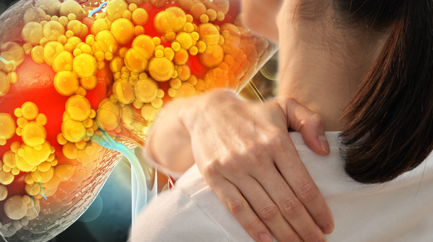 Karaciğerin bittiğini gösteren işarete dikkat! Hastaların yüzde 82'si aynı belirtiyi yaşıyor