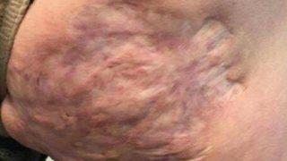 10 yıldır poposunun üstüne oturamıyordu! Onu bu hale neyin getirdiğine inanmayacaksınız