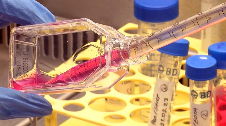 Kanseri can evinden vuracak çalışma! Tedaviyi önce laboratuvarda deniyorlar