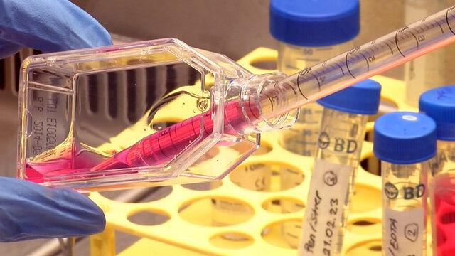 Kanseri can evinden vuracak çalışma! Tedaviyi önce laboratuvarda deniyorlar