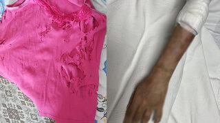 Tıkanan lavabosuna döktü, dehşeti yaşadı! Acısı dayanılacak gibi değildi, insanlar dikkatli olsun