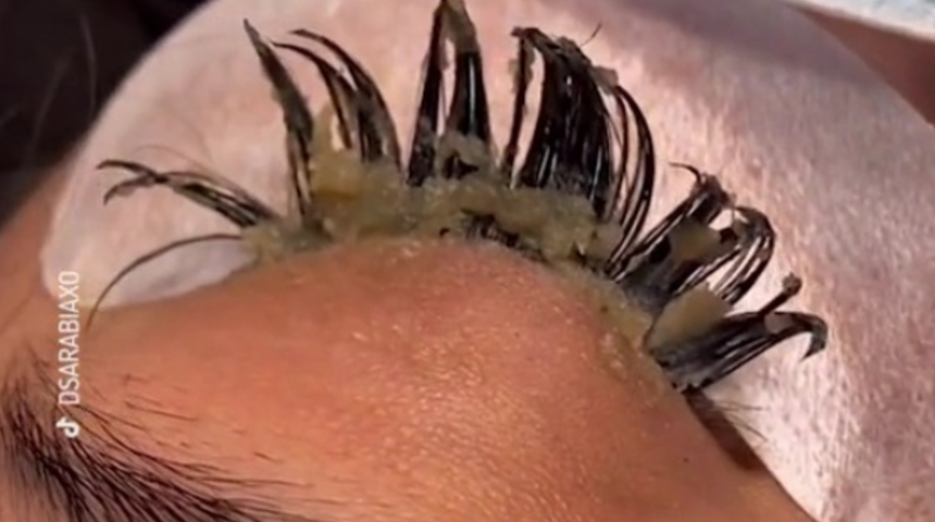 Müşterisinin kirpiklerini paylaşarak dehşete düştüğünü anlattı! Takma kirpikleri yapıştırmak için...