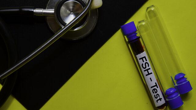 FSH hormonu nedir, kaç olmalı? FSH hormonu nasıl düşürülür, görevi nedir?