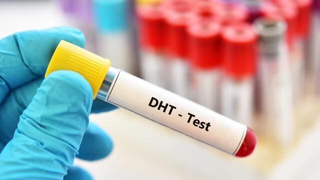DHT hormonu nedir, ne işe yarar? DHT hormonu fazlalığı belirtileri nelerdir, nasıl azaltılır?