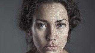 Cilt kuruluğu yapan nedenler ve çözümün püf noktaları