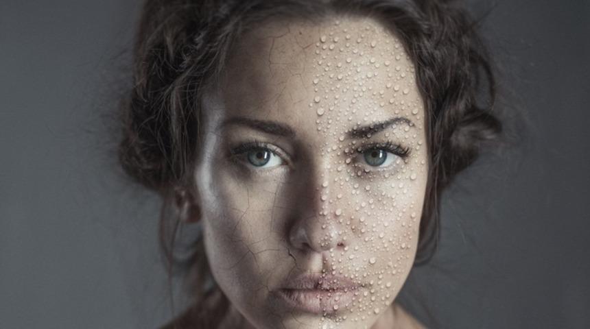 Cilt kuruluğu yapan nedenler ve çözümün püf noktaları