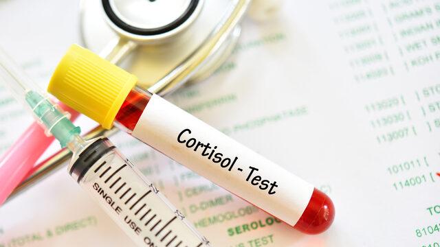 Kortizol hormonu nedir, ne işe yarar? Kortizol hormonu nasıl dengelenir ve düşürülür?