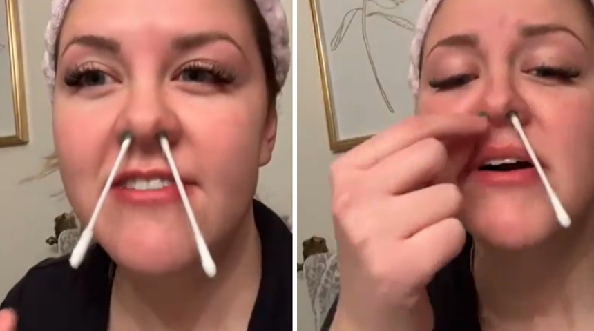 Burun kıllarına yapıştırdığı ağda başına iş a&ccedil;tı! Evde ağda yapmanın sonucu...