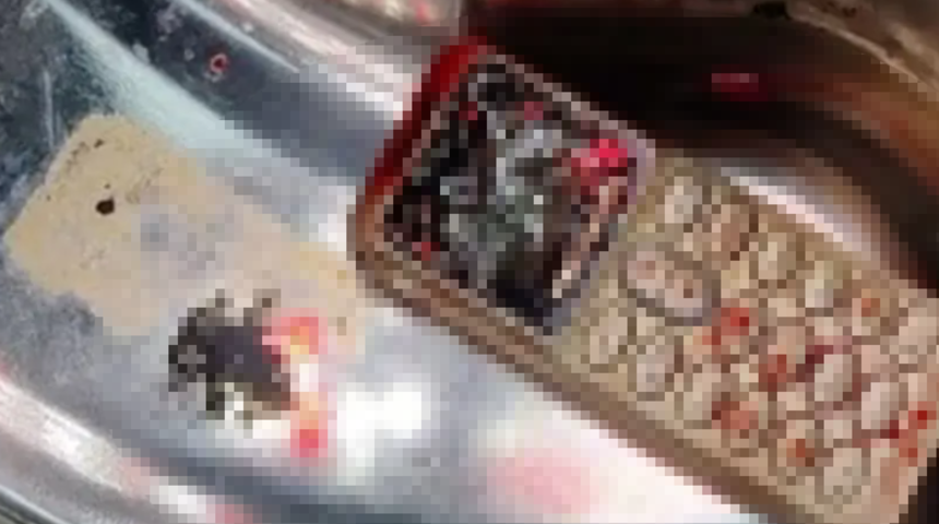 Kardeş kavgası hastanede bitti! Kardeşine vermemek için cep telefonunu yuttu... 2 saatlik cerrahi operasyonla çıkartıldı