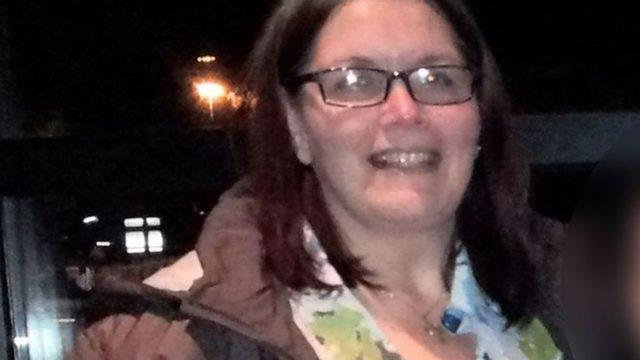 Kilo verme ameliyatı kötü sonuçlandı! Sarkan göğüsleri ve cildi cinsel hayatını bitirdi