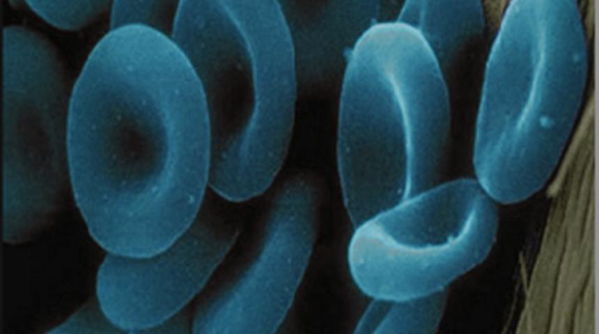 Sa&ccedil; D&ouml;k&uuml;lmesini Geride Bırakın