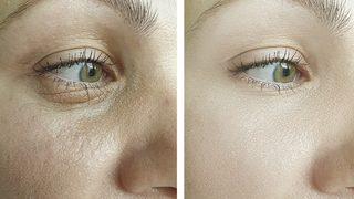 Güzellik uzmanının kırışıklıkları silip süpüren yaşlanma karşıtı bakımı! Bu doğal yağ botoks etkisi yaratıyor