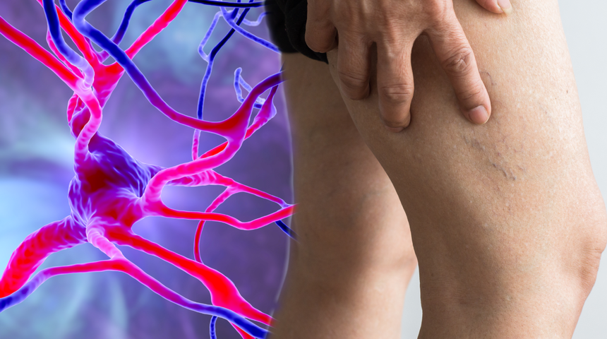 Felç geçirmeden aylar önce ortaya çıkan belirti! Bu semptomu fark etmek hayatınızı kurtarabilir…