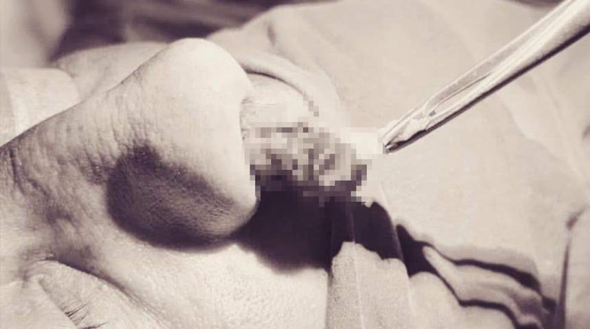 "Nefes almakta zorlanıyorum" dedi! Burnundan çıkanlar şaşkına çevirdi: 8 santimetre...