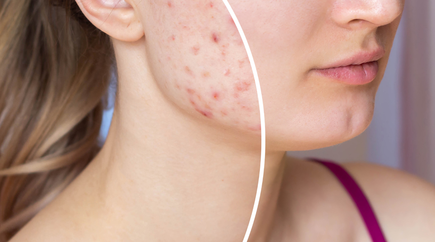 Cildinize yaptığınız en büyük hata! Üzerindeki bakteriler tuvaletten daha fazla