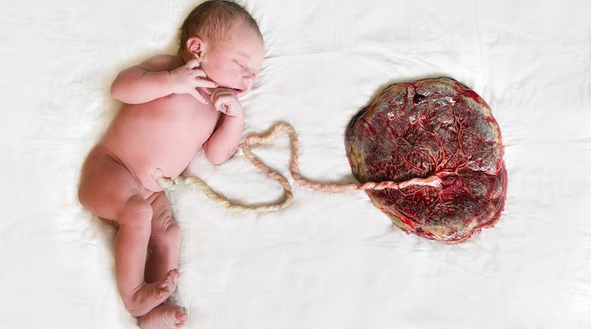 Plasentasını toz hale getirip yılbaşı s&uuml;s&uuml; yaptı