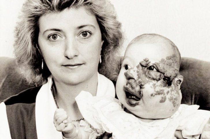 14 yılda 18 ameliyat oldu