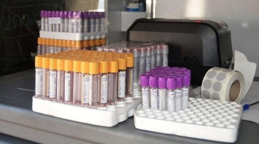 İnmeye karşı kök hücre