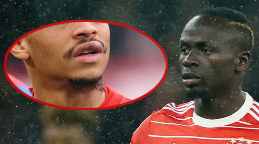 Son dakika: Sadio Mane'nin dövdüğü Leroy Sane'nin son hali herkesi şoke etti! Dudağını görenler şaşkınlığını gizleyemedi...