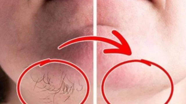 İstenmeyen tüylerden kurtulmanızı sağlayacak doğal çözüm! Lazer epilasyona gerek kalmadı