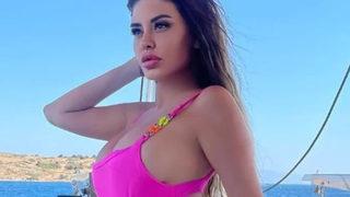 Ebru Polat'ın yüzünü görenler şoke oldu! Yaptırdığı yeni estetikleri saydı