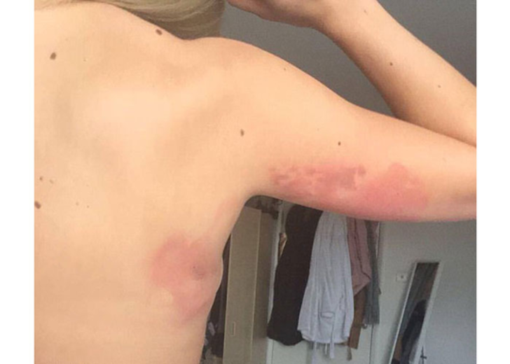 Gece kulübünde asitli saldırıya 25 yıl hapis cezası G4